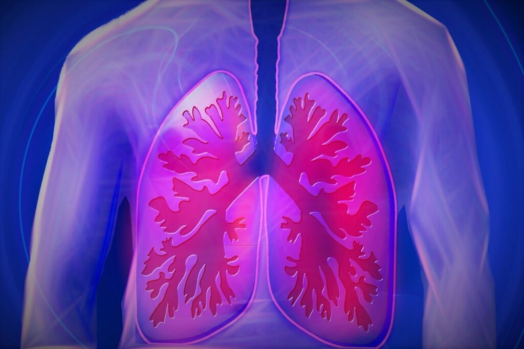 Quali sono i sintomi della polmonite